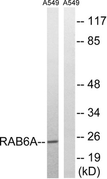 Rab 6A antibody