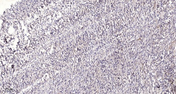 Rad23A antibody