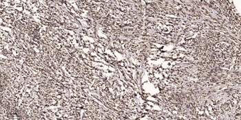 Rad51 (phospho-Tyr315) antibody