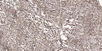 Rad51 (phospho Tyr315) rabbit pAb
