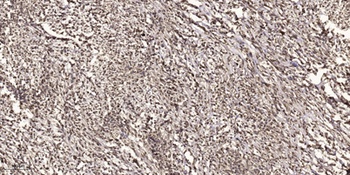 Rad51 (phospho Thr309) rabbit pAb