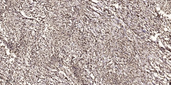 Rad51 (phospho-Thr309) antibody