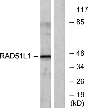 Rad51B rabbit pAb