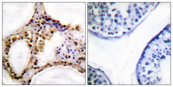 Rad52 (phospho Tyr104) rabbit pAb