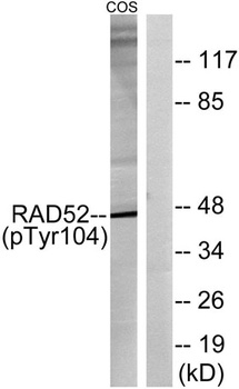 Rad52 (phospho-Tyr104) antibody