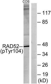 Rad52 (phospho Tyr104) rabbit pAb