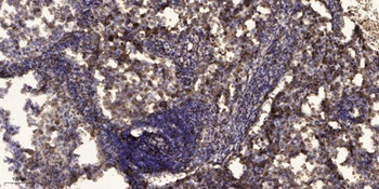 Raf-1 (phospho-Ser43) antibody