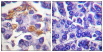 Raf-1 (phospho-Tyr341) antibody