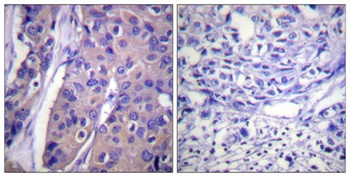 Raf-1 (phospho-Ser296) antibody