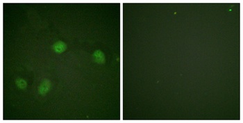 Raf-1 (phospho Ser621) rabbit pAb