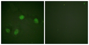 Raf-1 (phospho-Ser621) antibody