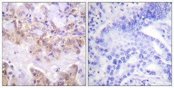 Raf-1 (phospho Ser621) rabbit pAb