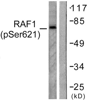 Raf-1 (phospho Ser621) rabbit pAb