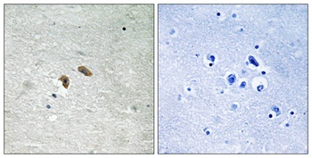 Raf-1 (phospho-Thr269) antibody