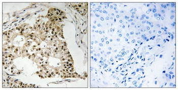 RARα (phospho Ser77) rabbit pAb