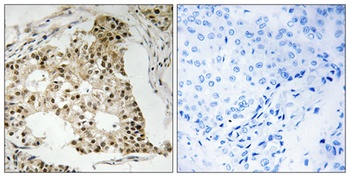 RAR alpha (phospho-Ser77) antibody