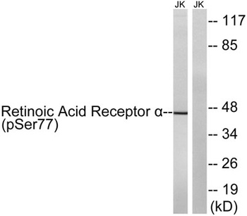 RAR alpha (phospho-Ser77) antibody