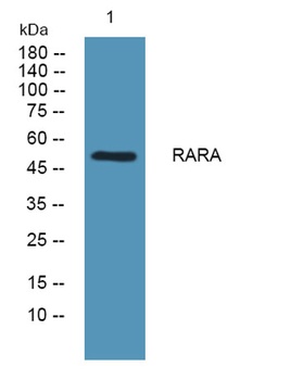 RAR alpha antibody