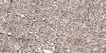 RAR alpha antibody