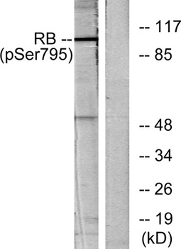 Rb (phospho-Ser795) antibody