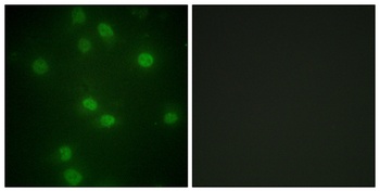 Rb (phospho Ser811) rabbit pAb