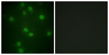 Rb (phospho-Ser811) antibody