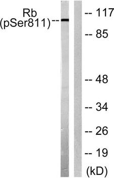 Rb (phospho Ser811) rabbit pAb