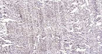 Rb (phospho-Ser811) antibody