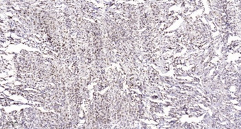 Rb (phospho Ser811) rabbit pAb