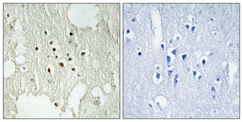 Rb (phospho Thr826) rabbit pAb