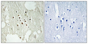 Rb (phospho-Thr826) antibody