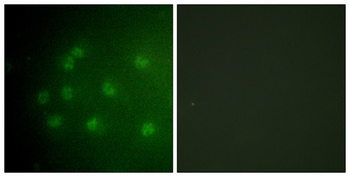 Rb (phospho-Thr826) antibody