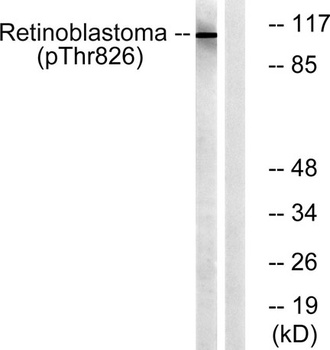 Rb (phospho-Thr826) antibody