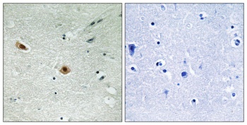 Rb (phospho Ser608) rabbit pAb