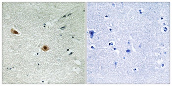 Rb (phospho-Ser608) antibody