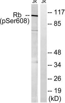 Rb (phospho-Ser608) antibody