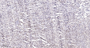 Rb (phospho Ser788) rabbit pAb
