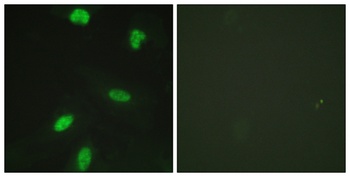 Rb (phospho Thr821) rabbit pAb