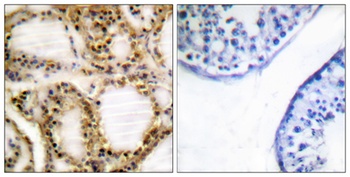 Rb (phospho Thr821) rabbit pAb