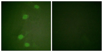 Rb (phospho Ser249) rabbit pAb