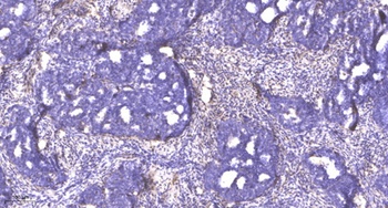 Rb (phospho Ser249) rabbit pAb