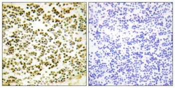 p107 (phospho Thr369) rabbit pAb