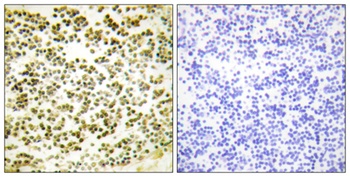 p107 (phospho-Thr369) antibody