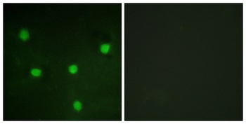 p107 rabbit pAb Antibody