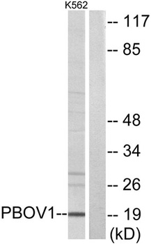 UROC28 antibody