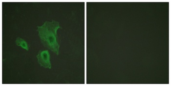 Bcl-2 (phospho-Thr69) antibody