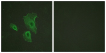 Bcl-2 (phospho Thr69) rabbit pAb