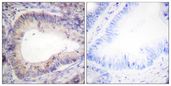 Bcl-2 (phospho Thr69) rabbit pAb