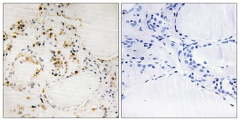 Bcl-2 (phospho Ser87) rabbit pAb
