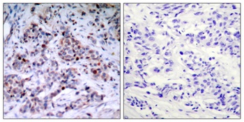 NFκB-p65 (phospho Thr435) rabbit pAb